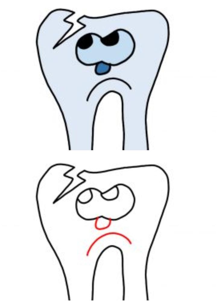 Tooth Cavity Drawing